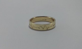 Обручальное кольцо кардиограмма